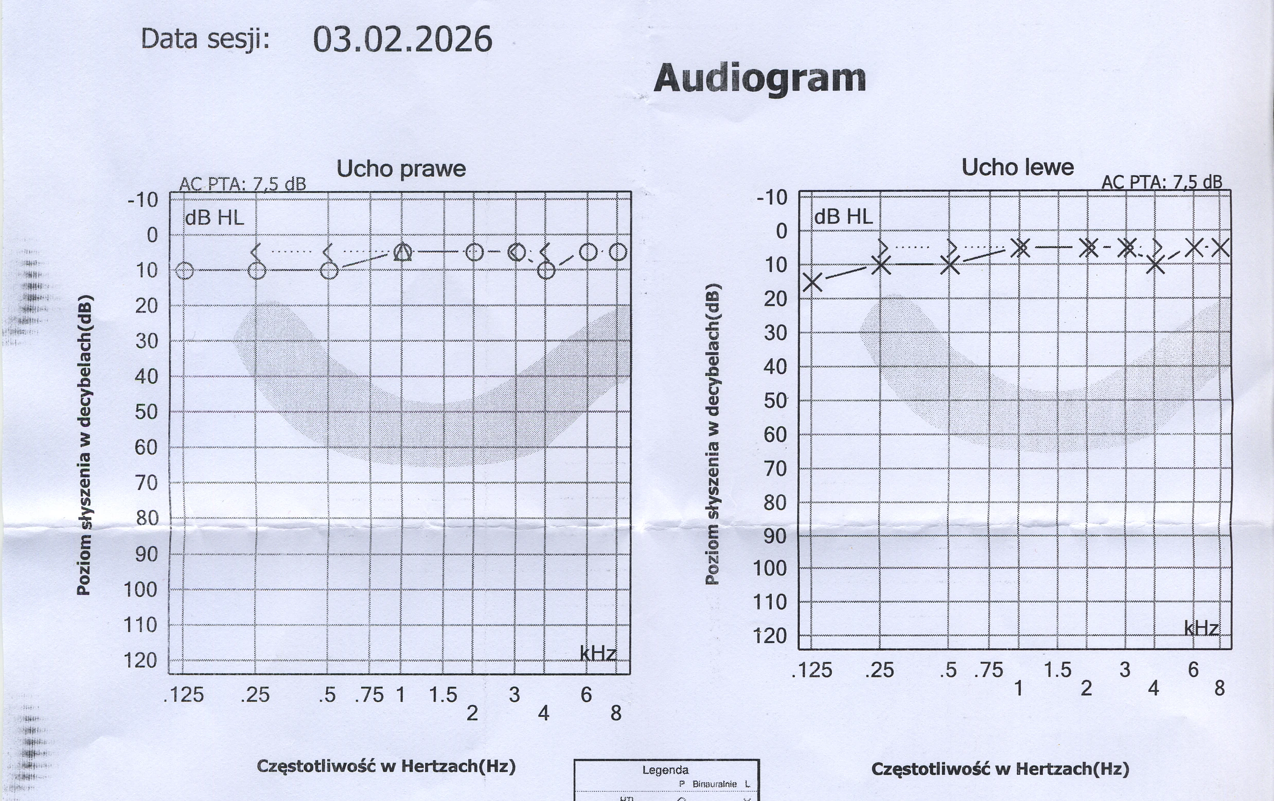 Audiogram 03.02.2026